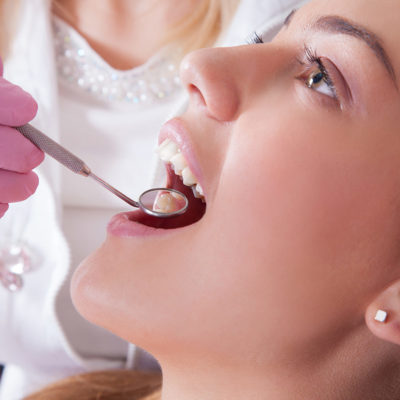 Conservativa studio odontoiatrico zucchi | Dentista Milano
