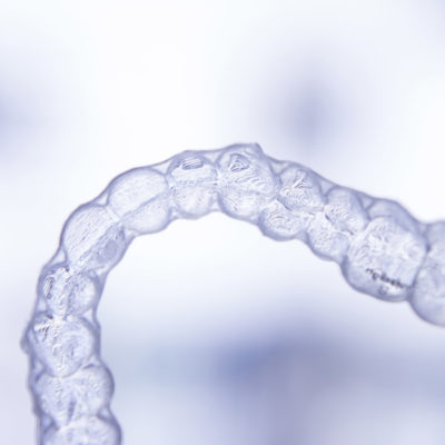Ortodonzia invisibile | Studio zucchi milano